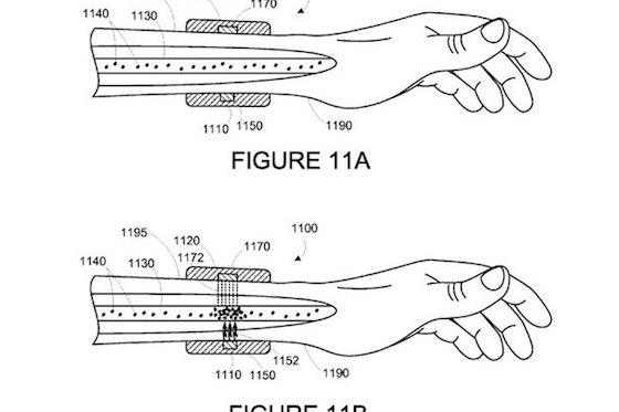 googleがガン細胞除去ウェアラブルデバイス開発 世界知的所有権機関に特許出願、5年程度で実用も