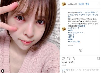 坂口杏里 手のケガは嘘 風俗の接客がおざなりな 裏事情 って 19年5月22日 エキサイトニュース