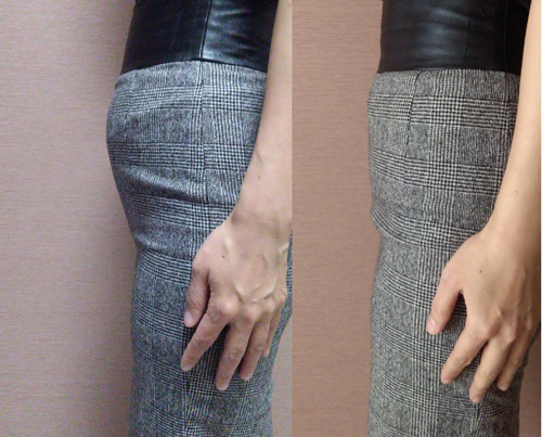 臓器は動きますか?