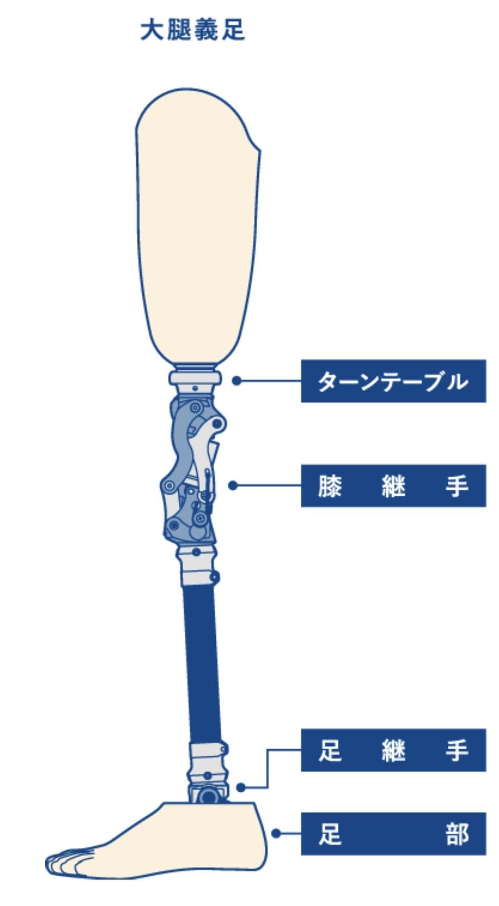 低価格で安心安全な『義足用膝継手』を共同開発 ユーザーに優しく練習不要、転倒リスク低減 -- 広島国際大学 (2022年3月7日) -  エキサイトニュース