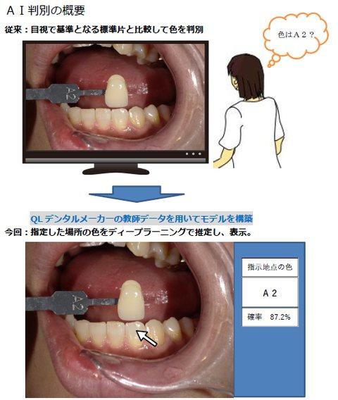 Aiの技術を歯科医療に活用 明星大学情報学部植木研究室が歯科技工所と共同研究 19年8月29日 エキサイトニュース