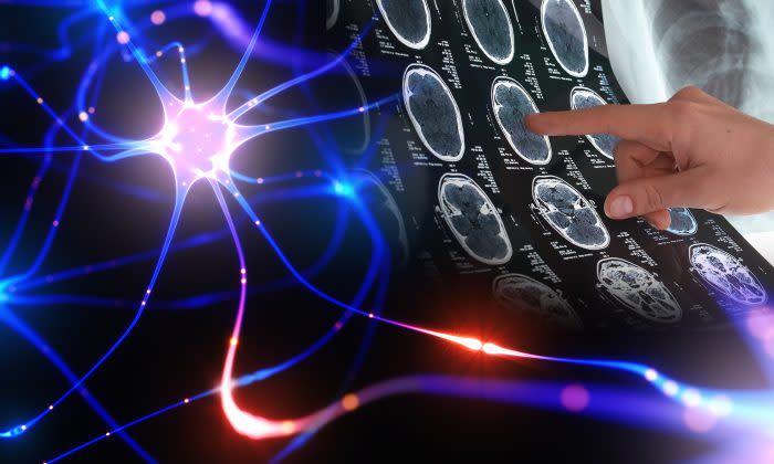 体は死んでもまだ 生きている 死後の意識について研究者が語る 19年8月26日 エキサイトニュース