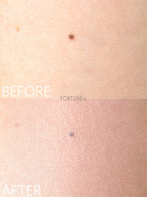 19秋冬コレクションwho Meeが9 発売 7アイテムを紹介 ローリエプレス