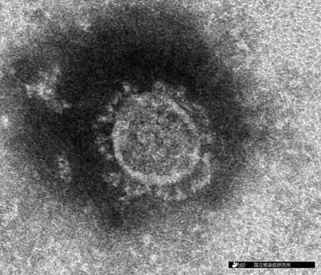 ２万年前に東アジアで流行＝コロナウイルス、遺伝子に痕跡―豪米研究チーム (2021年6月25日) - Vimarsana News