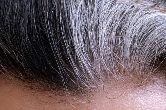 ストレスで白髪が増えるは本当だった ストレスホルモンを制御する遺伝子が色を作る毛包を変化させる 米研究 18年5月6日 エキサイトニュース