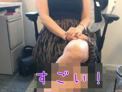 これ どうなってるの 足を組んだ女性の写真が注目を集める 16年6月25日 エキサイトニュース