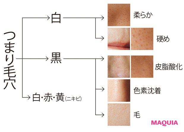 毛穴のつまりが 柔らかくて白い 人必見 メカニズムから解消法までをプロが教えます ローリエプレス