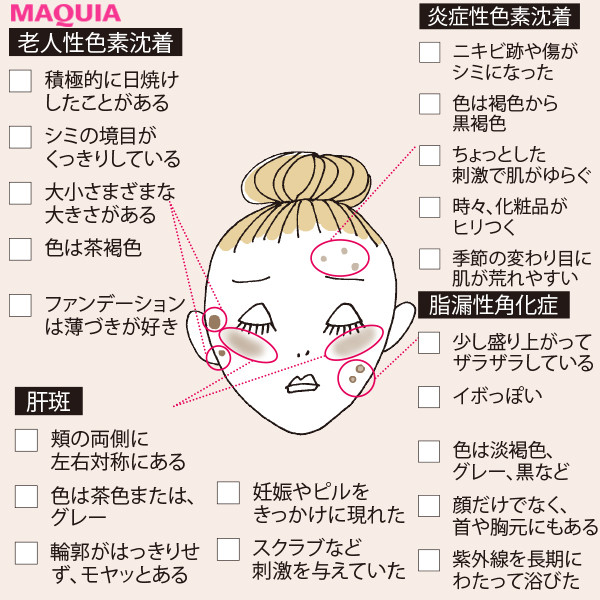 いま必要な美白はコレ シミタイプがわかる 診断チェックリスト つき ローリエプレス