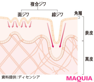 30代におすすめのシワ対策は シワケアや予防法を美容のプロが徹底解説 ローリエプレス