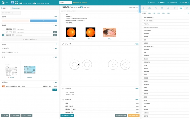 クリニカル プラットフォーム 眼科診療所向けクラウド電子カルテ Clipla Eye の提供を開始 2017年8月23日 エキサイトニュース
