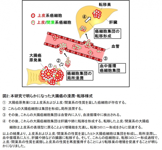 乳癌の浸潤 転移を促進する新たなメカニズムを発見 学校法人 順天堂のプレスリリース
