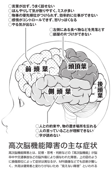 交通事故で人格まで変わってしまう 高次脳機能障害 をめぐる非情な現実 19年9月28日 エキサイトニュース 4 9