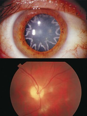 電気工事士 14 000ボルトの高圧感電事故で瞳の中に 星 加州 14年1月28日 エキサイトニュース