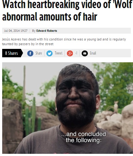 家系の30人が同じ病気 メキシコの 狼男 が 先天性多毛症を理解して 14年7月6日 エキサイトニュース