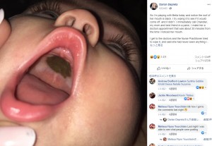 娘の口内に黒い痣のようなものが 母親は心配で涙するも意外な結末 米 19年7月18日 エキサイトニュース 2 2