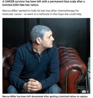 がん治療で髪を失った男性 ヘアタトゥーで頭部が青いヘルメットのように スコットランド 19年11月27日 エキサイトニュース