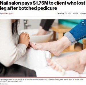 ネイルサロンでペディキュア中に小さな傷 55歳女性が片脚切断で2億円超の和解金 米 21年12月30日 エキサイトニュース ネイルサロンでペディキュア中に小さな傷 55歳女性が片脚切断で2億円超の和解金 米 21年12月30日 エキサイトニュース