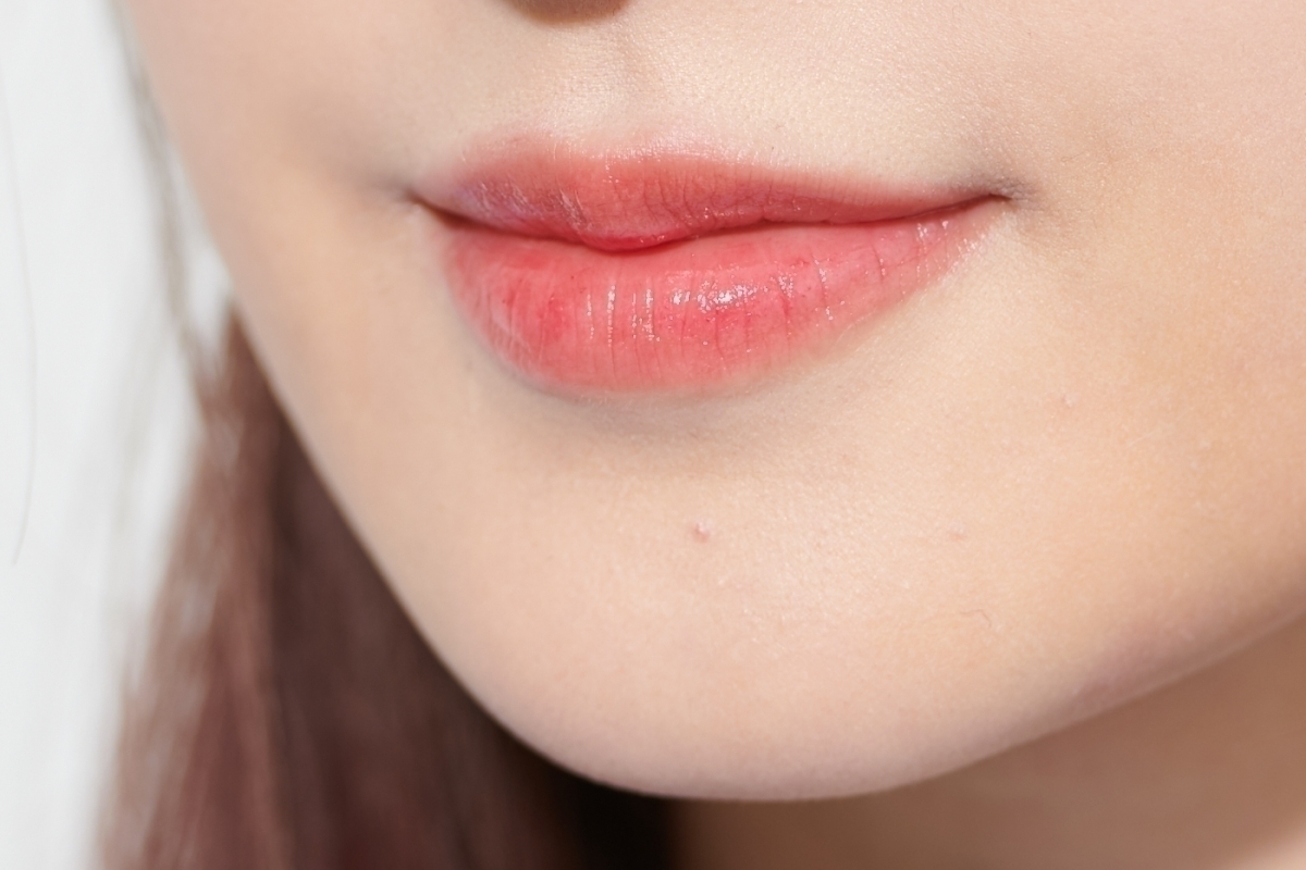 ニキビ リップ ヘア 女の子の3大トラブルのケア方法を大公開 ローリエプレス