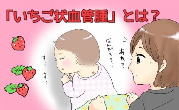 娘の背中に いちご状血管腫 これって治療したほうがいい 体験談 年5月25日 ウーマンエキサイト 1 2