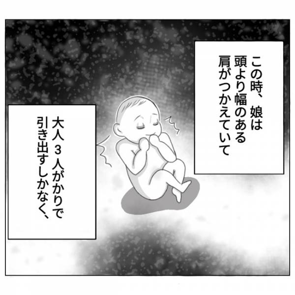 ビリッ！「めちゃ痛い…」股が破けた！？出産後、赤ちゃんを一度も抱けずに運ばれて不安に #5(2021年9月17日)｜ウーマンエキサイト - Vimarsana News