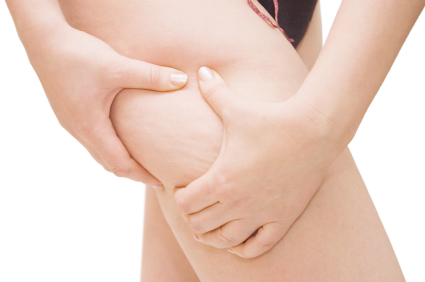 できてからでは遅い 生活習慣で防ぐ攻めのセルライトケア 12年8月17日 ウーマンエキサイト 1 3