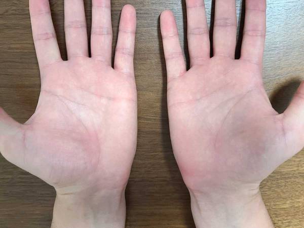 手相の見方が分からない 基本は右手 左手どっち 生命線は長さではなく 年9月7日 ウーマンエキサイト 1 4