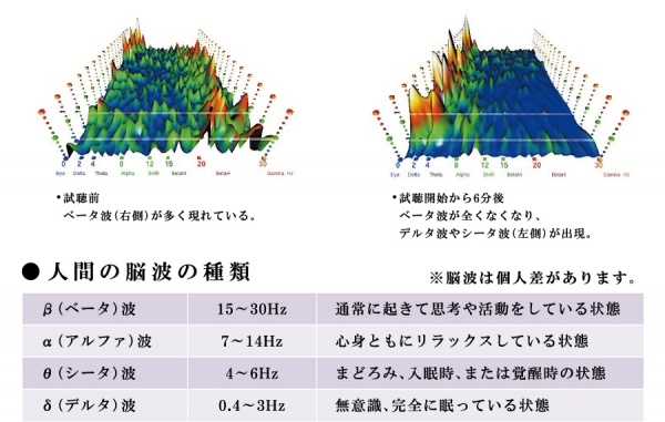 脳波データ