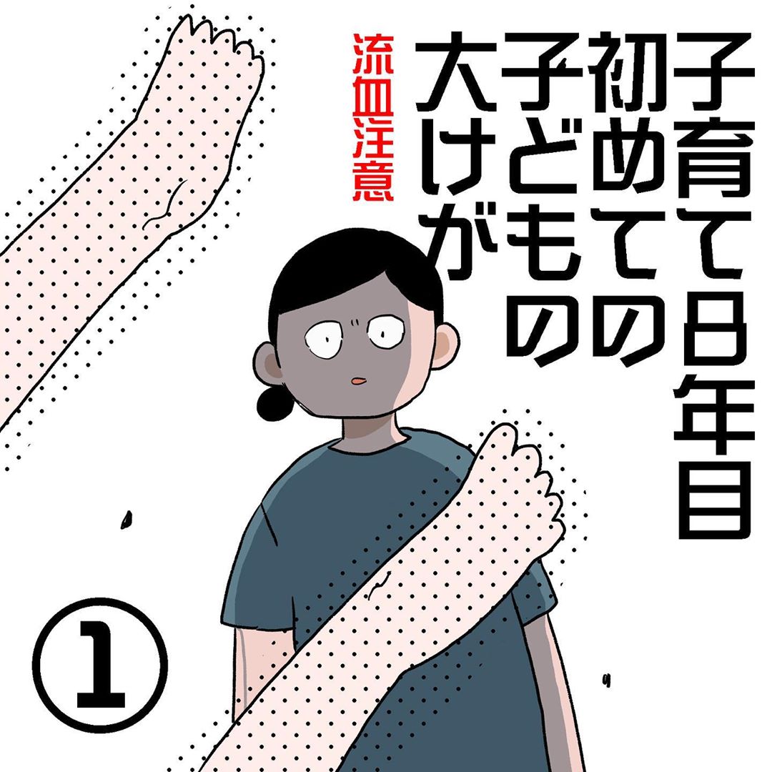 子育て8年目 子どものケガは突然に 叫び声の先に居たわが子は 初めての子どもの大けが Vol 1 マピオンニュース