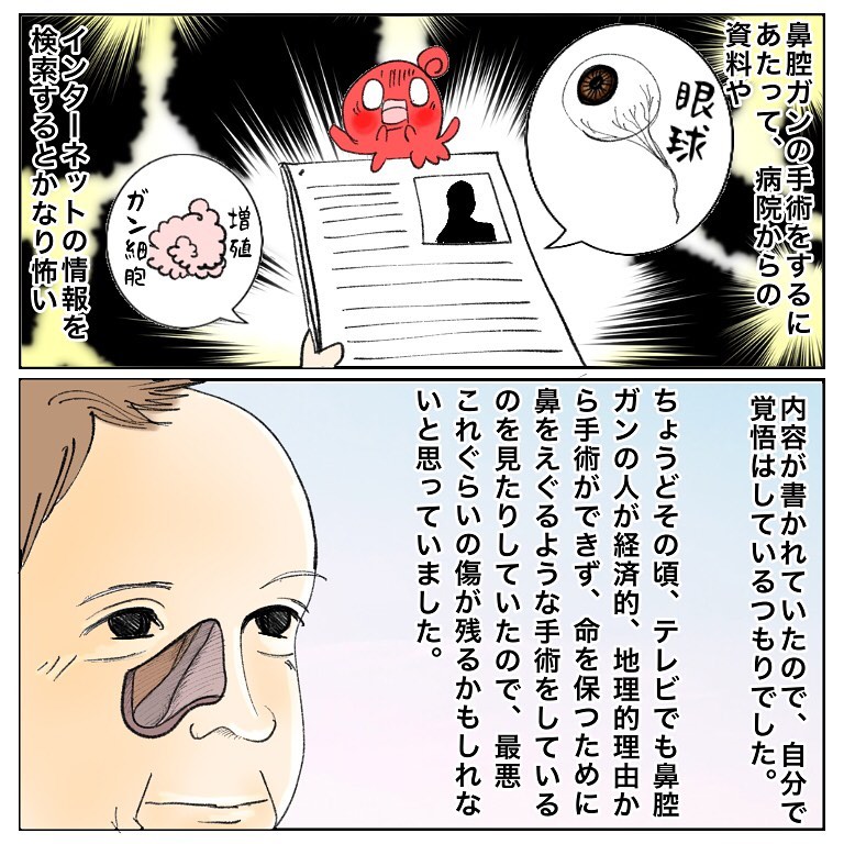 自分の顔が変わってしまうかも 黒ずんだ鼻を見て怖くなる日々 鼻腔ガンになった話 Vol 57 記事詳細 Infoseekニュース