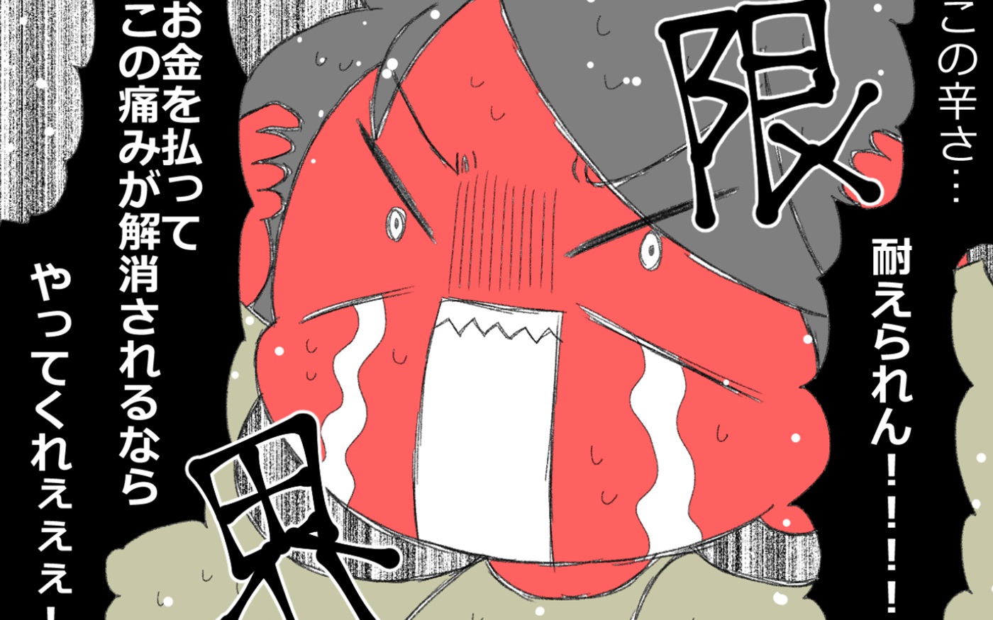 ボトックスの費用